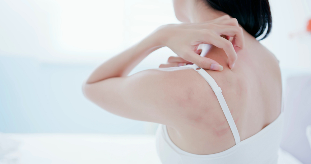 Radiodiagnostic allergies 999x667px